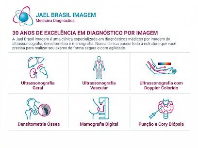 Jael Brasil Alcântara Ferreira