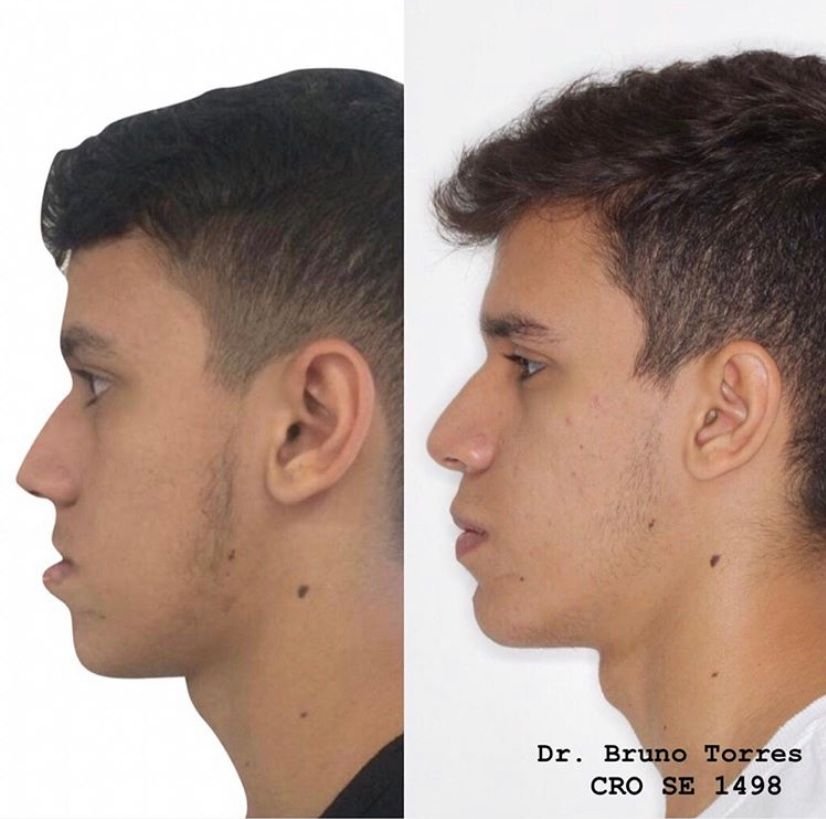 Dr. Bruno Torres
