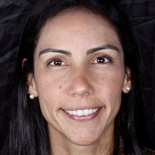 Camila Boasquevisque