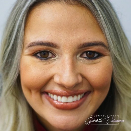 Dra. Gabriella Valadares