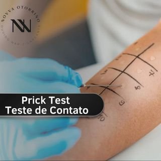 Exame Teste Alergico
