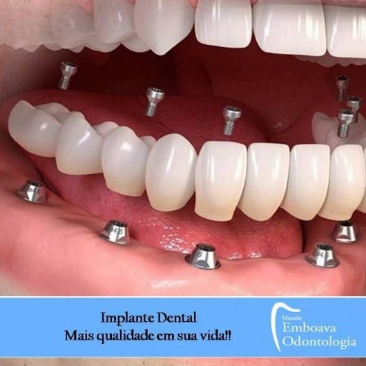 Dr. Marcelo Emboava Felisberto