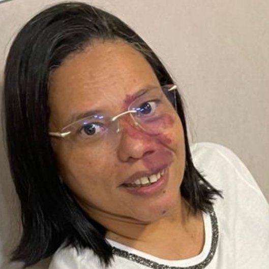 Dra. Ana Beatriz Teixeira Vianna