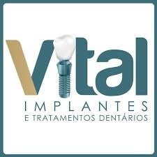 Vital Implantes e Tratamentos Dentários